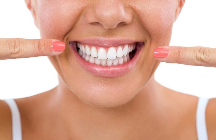 At-Home Teeth Bleaching: Tips for a Whiter Smile