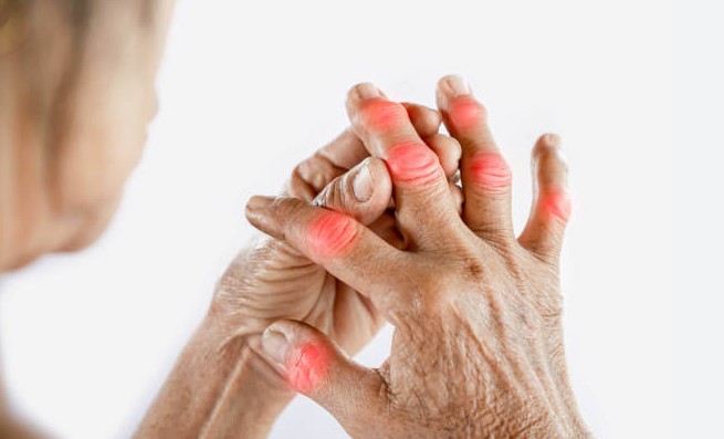 Managing Swollen Hands and Fingers: Causes and Solutions