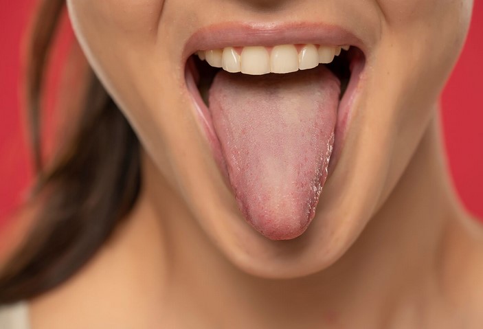 Understanding White Tongue: Normal Variations and Concerns