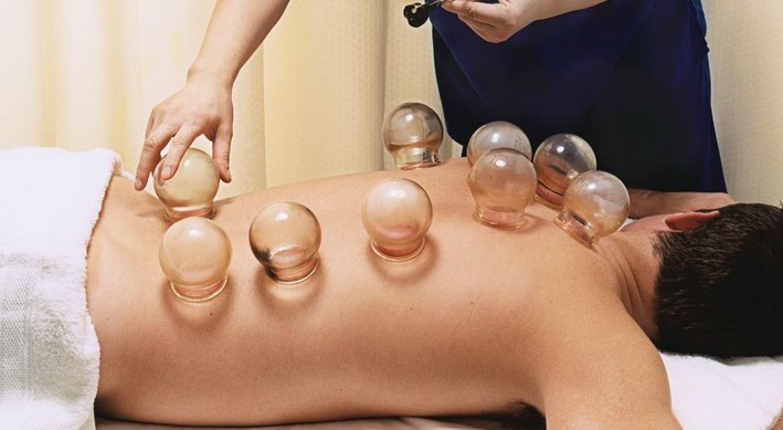 Ventosa Massage: Benefits and Practices of Cupping Therapy